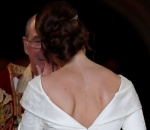 Gaun Indah Putri Eugenie Perlihatkan Bekas Luka di Tubuhnya