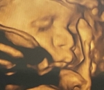 Potret USG bayi rupawan
