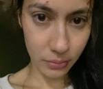 Muka Sampai Babak Belur