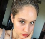 Tampilkan Freckles