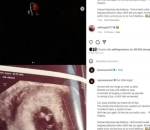 Isyana Sarasvati Alami Keguguran