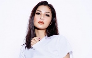 Muka Cemong, Mikha Tambayong Tetap Dipuji Cantik 