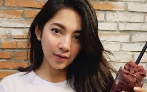 Dinda Kirana Pulih dari Cedera Kakinya