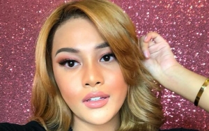 Aurel Hermansyah Makin Cantik Usai Ganti Warna Rambut, Netter: Itu Ada Ketombenya?