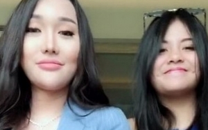 Didepak dari Duo Bunga, Lucinta Luna Gandeng Rekan Duet Baru