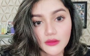 Dituding Netter Edit Foto, Kekasih Billy Syahputra Beri Jawaban Menohok