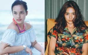 Dulunya Pacari Chico Jericho, Netter Heboh Chelsea Islan dan Mikha Tambayong Akur Double Date
