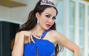 Jelaskan Soal Insiden Bikini Melorot, Cynthiara Alona: Itu Yang Kelihatan Rambut Saya
