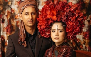 Uniknya Riasan Pre-Wedding Tasya Kamila Pakai Freckles, Ala Meghan Markle?