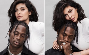 Jadi Sorotan, Inilah Cerita di Balik Bekas Luka Kylie Jenner