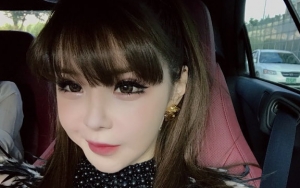 Sapa Fans dengan Foto Cantik Baru, Park Bom Kini Gemukan?