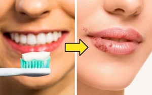 Gunakan Sikat Gigi untuk Mengatasi Bibir Gelap