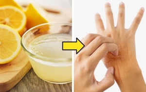 Jus Lemon dan Minyak Kelapa untuk Pertumbuhan Kuku