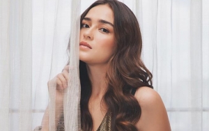 Ramai Selebriti Pakai Riasan Bintik-Bintik, Yasmine Wildblood Pamer Freckles Asli Bule