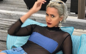 Gigi Kelewat Putih dan Disindir Lakukan Permak, Kimmy Jayanti Beri Respon Tak Terduga