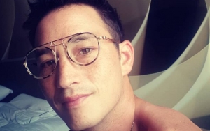 Unggah Foto Bangun Tidur, Mike Lewis Pamer Freckles Asli