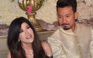 Akhirnya Tunangan Denny Sumargo Blak-Blakan Soal Tudingan Operasi Plastik