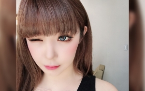 Unggah Foto Baru, Memar-Memar di Kaki dan Lengan Park Bom Jadi Sorotan