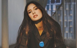 Aurelie Moeremans Pamer Wajah Tanpa Makeup, Bagian Bibir Jadi Sorotan Netter