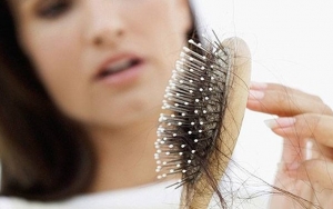 Minyak Ikan juga Dapat Mencegah Kerontokan Rambut