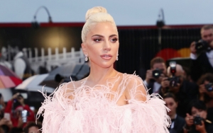 Terlihat Awet Muda, Lady Gaga Dituding Lakukan Oplas