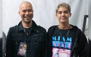 Bantah Mabuk, Ahmad Dhani Ungkap Al Ghazali Kecelakaan Hingga Cedera di Bagian Ini