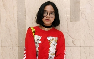 Pamer Freckles, Riasan Cinta Kuya Ini Justru Disebut Mirip Cacar