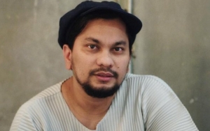 Tompi Buka-Bukaan Soal Ratna Sarumpaet, Berapa Tarif Oplasnya?