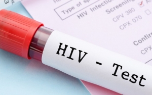 Penularan Virus HIV dan Hepatitis
