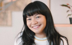Dituding Lakukan Operasi Plastik Gara-Gara Makin Cantik, Amel Carla Beri Tanggapan