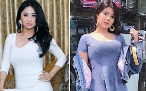 Dewi Persik Cantik Alami, Keponakan Dibully Soal Wajah Asli Sebelum Terkenal Hingga Aib Ketiak Basah