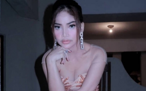 Terbiasa Perawatan Kecantikan Sejak SMA, Irma Darmawangsa Lakukan Suntik Botox Demi Ini