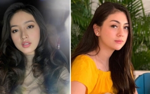 Dipuji Lebih Cantik dari Wilona, Celine Pamer Paha Mulus Bebas Lemak Saat Temani Putra Tampan
