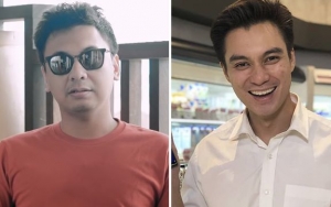 Baim Wong Lengser dari Posisi Presiden Jomblo, Raditya Dika Beri Imbauan Pernikahan