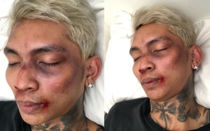 Hoaks Young Lex Ngaku Dipukuli Fans K-Pop Garis Keras