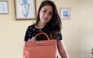 Jujur Pernah 'Liar' Sebelum Nikahi Stefan William, Wajah Cantik Celine Evangelista Bukti Bebas Oplas