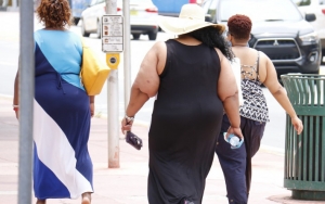 Obesitas Sebabkan Selangkangan Menghitam