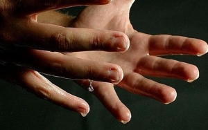 Hiperhidrosis Sebabkan Telapak Tangan Bekeringat