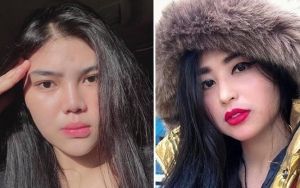 Meldi Koar-Koar Jadi Bidadari Jokowi Saat Kakek Sakit, Dewi Persik Sindir Karma Anak Durhaka
