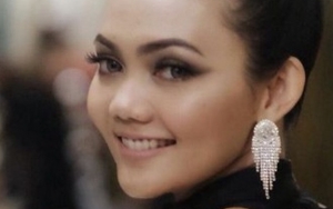  Rina Nose Unggah Foto Cantik, Netter Tak Beri Ampun Nyinyir