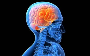 Melindungi Otak dari Penyakit Alzheimer