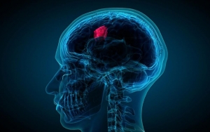 Tanda Radang, Cedera dan Tumor Sistem Saraf Pusat