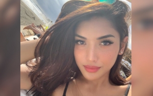 Millen Cantik Berbikini Ala Kendall Jenner, Dibully Hitam dan Pakai Pembalut Sembunyikan Kelamin