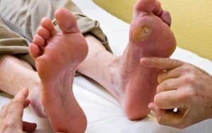 Periksakan Luka ke Dokter Jika Makin Parah