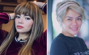 Dinar Candy Ngaku Pernah Dibully Nikita Mirzani Tapi Tak Sakit Hati Apalagi Dendam, Kok Bisa?