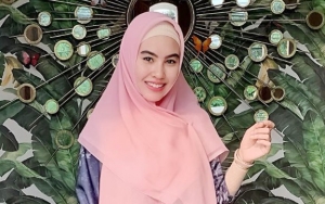 Berstatus Istri Habib, Foto Kartika Putri Pakai Kawat Gigi Hingga Kontak Lensa Tuai Pro Kontra
