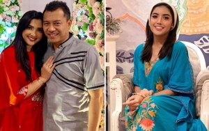 Anang Ngegas Istri Disebut Mirip Millendaru, Ashanty Menor Pamer Pipi 'Memar' Diledek Korban KDRT