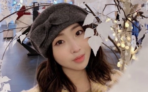 Minzy Eks 2NE1 Dipuji Makin Cantik, Netter: Ya Gara-Gara Oplas