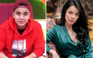 Pacar Cantik Billy Syahputra Mirip Nikita Mirzani, Lubang Hidung dan Wajah Dibully Hasil Oplas