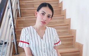 Kezia Karamoy Posting Pipi Merah Ngeluh Kepanasan, Netter Puji Bak ABG Hingga Mirip Lisa BLACKPINK